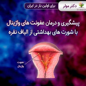 درمان عفونت های زنانه با شورت نقره